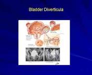 Urinary Bladder-Congenital Anomalies PowerPoint Presentation