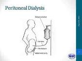 Hemodialysis And Peritoneal Dialysis