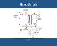 The Transition From Chronic Kidney Disease-CKD To Kidney Failure PowerPoint Presentation Notes