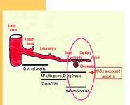 Henoch-Schonlein Purpura PowerPoint Presentation