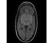 Emergencies In Nephrology PowerPoint Presentation