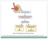 Nephrotic Syndrome PowerPoint Presentation
