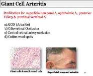 Ocular Manifestations of Systemic Diseases PowerPoint Presentation