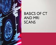 Basics of CT and MRI Scans PowerPoint Presentation