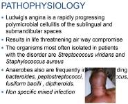 Ludwigs Angin Medical Notes