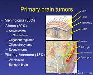 About Brain Tumors PowerPoint Presentation Notes