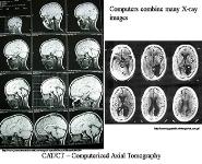 Brain Scans PowerPoint Presentation