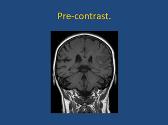 Neuroimaging Pearls For The Primary Care Provider