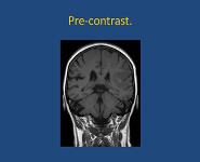 Neuroimaging Pearls For The Primary Care Provider PowerPoint Presentation Notes