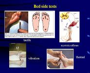 Neuromuscular Diseases PowerPoint Presentation Notes