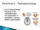Parkinsons Disease