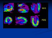 Nuclear Cardiology-Basics