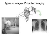 Multimodality Pet-Ct Imaging