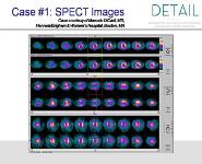 Pet Myocardial Perfusion Imaging-MPI PowerPoint Presentation Notes