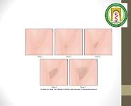 Puberty PowerPoint Presentation