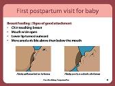 Care After Delivery-Postpartum Care
