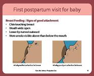Care After Delivery-Postpartum Care PowerPoint Presentation