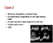 Role of Cesarean Myomectomy In Contemporary Practice PowerPoint Presentation