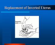 Postpartum Haemorrhage PowerPoint Presentation