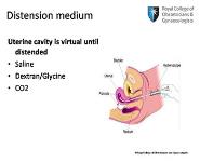 Principles of Safe And Effective Hysteroscopy PowerPoint Presentation Notes