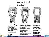 Comprehensive Abortion Care