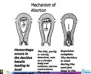 Comprehensive Abortion Care PowerPoint Presentation