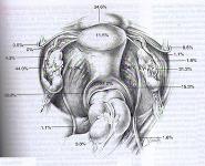 Endometriosis PowerPoint Presentation
