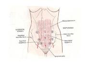 Endoscopy In Gynecology PowerPoint Presentation