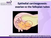 Endometrial And Other Cancers In The Menopause