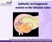 Endometrial And Other Cancers In The Menopause PowerPoint Presentation