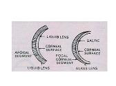 Optics of Contact Lenses