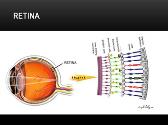 Diabetic Retinopathy