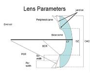 Introduction To Contact Lenses PowerPoint Presentation Notes