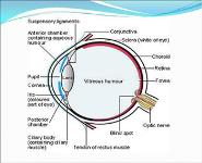Uveitis PowerPoint Presentation Notes
