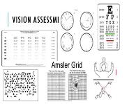 Vision Rehabilitation PowerPoint Presentation
