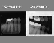 Forensic Odontology PowerPoint Presentation