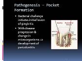 Chronic Periodontitis