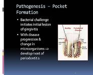 Chronic Periodontitis PowerPoint Presentation