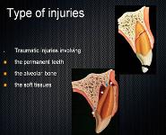 The Traumatic Injuries of Permanent Teeth And Complex Therapy PowerPoint Presentation Notes