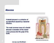 Protecting All Childrens Teeth-Common Oral Pathology PowerPoint Presentation