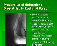 Orthotics and Prosthetics PowerPoint Presentation