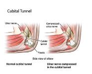 Ulnar Nerve Anatomy and Its Lesions PowerPoint Presentation