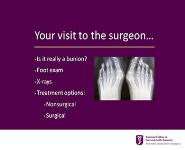 Bunions And Hammertoes PowerPoint Presentation