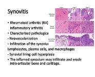Arthritis-Approach To Diagnosis PowerPoint Presentation Notes