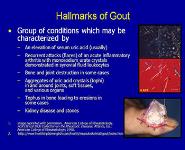 Clinical Aspects of Gout PowerPoint Presentation
