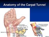 Carpal Tunnel Syndrome
