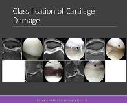 Cartilage Injury and Surgical Treatment PowerPoint Presentation Notes