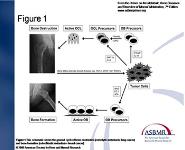 Orthopedic Treatment of Metastatic Bone Disease PowerPoint Presentation