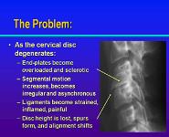 Neck and Arm Pain PowerPoint Presentation