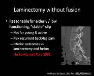 Degenerative Spondylolisthesis PowerPoint Presentation